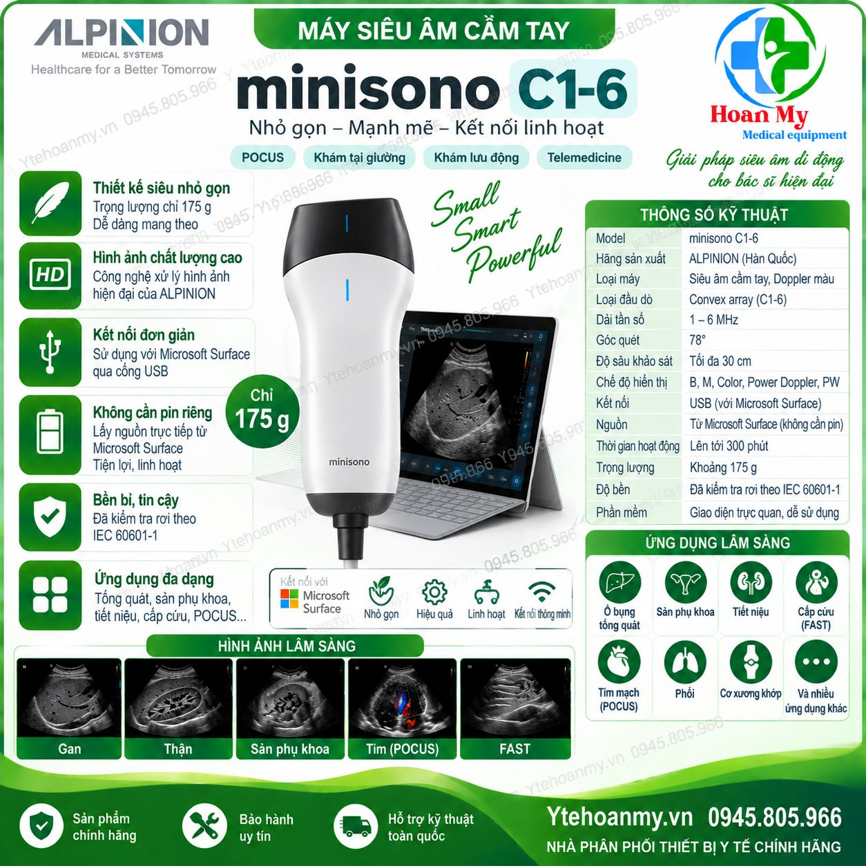 Top 6 máy siêu âm cầm tay đáng mua nhất hiện nay - VINNO, Chison SonoEye, minisono